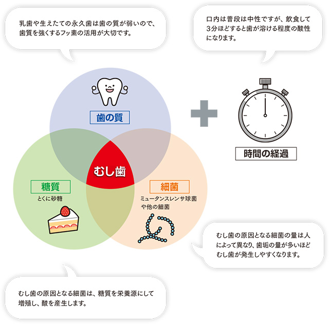 むし歯が起こりやすくなる要因